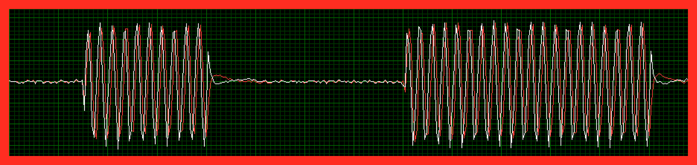 rf_pulse